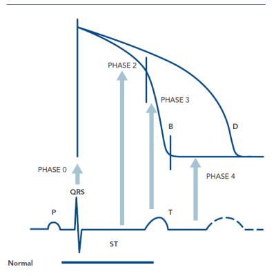 Figure 1 Correlation Between Ventricular Cellular Action Potential and Surface ECG