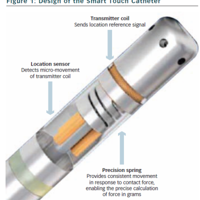 Figure 1 Design of the Smart Touch Catheter