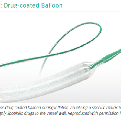 Drug-coated Balloon