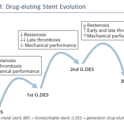 Figure 1 Drug-eluting Stent Evolution