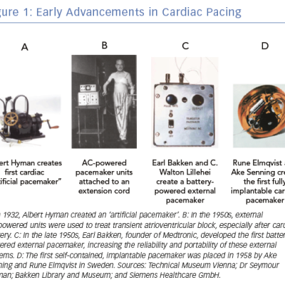 Early Advancements in Cardiac Pacing