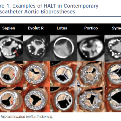 figure 1-examples-of-halt-in-contemporary