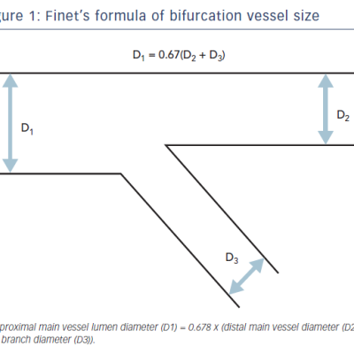 Figure 1 Finet’s formula of bifurcation vessel size