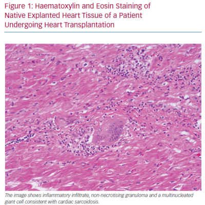 Haematoxylin and Eosin Staining