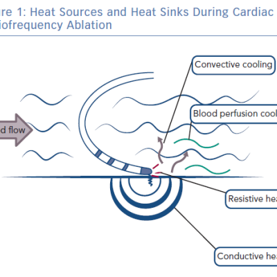 Heat Sources and Heat Sinks During Cardiac Radiofrequency Ablation