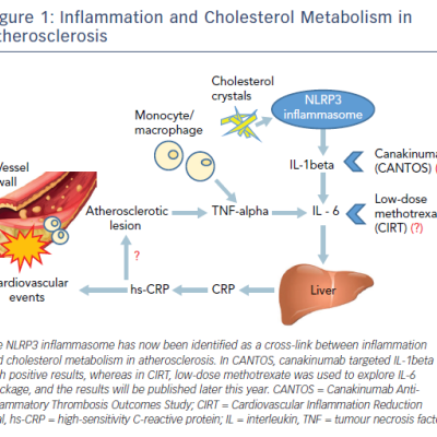 Figure 1 Inflammation and Cholesterol Metabolism in Atherosclerosis