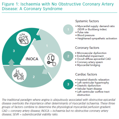 Ischaemia with No Obstructive Coronary Artery Disease A Coronary Syndrome