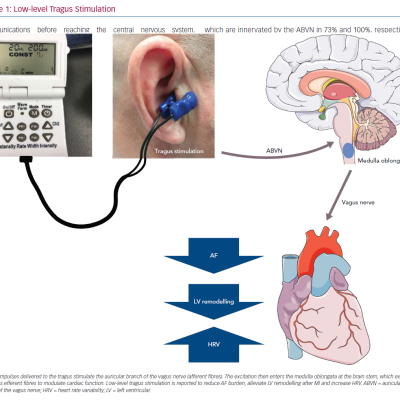 Low-level Tragus Stimulation