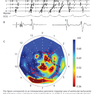 Mechanistic Basis of Decrement Evoked Potential Mapping