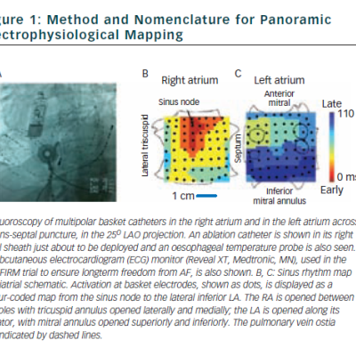 Figure 1 Method and Nomenclature for Panoramic Electrophysiological Mapping