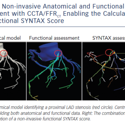 Figure 1 Non-invasive Anatomical and Functional Assessment with CCTA/FFRCT Enabling the Calculation of a Functional SYNTAX Score