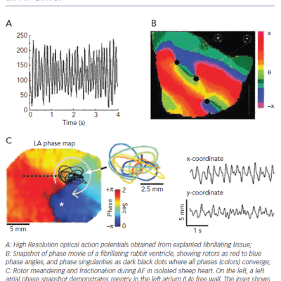 Optical Mapping of Fibrillatory Conduction from an AF Driver