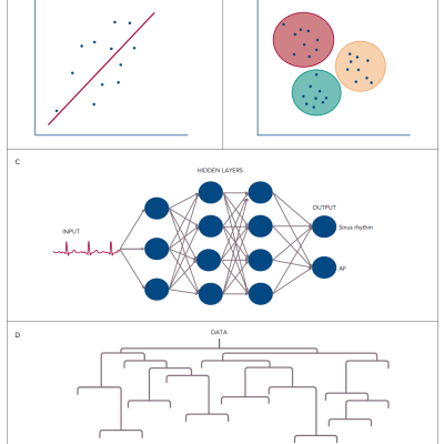 Pictorial Representations of Common Machine Learning Techniques