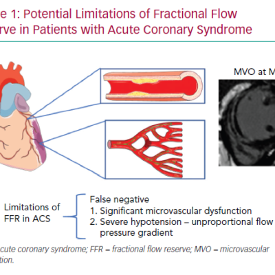 Potential Limitations of Fractional Flow Reserve in Patients