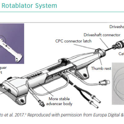 Rotablator System