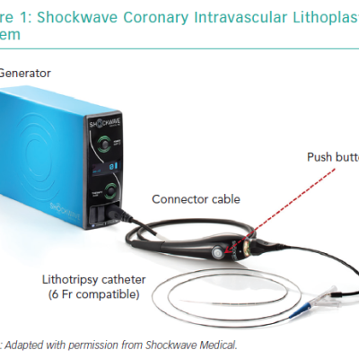 Shockwave Coronary Intravascular Lithoplasty System