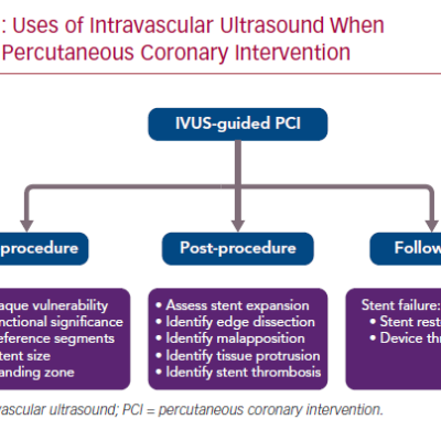 Uses of Intravascular Ultrasound When Guiding Percutaneous Coronary Intervention
