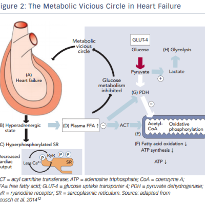 Figure 2 The Metabolic Vicious Circle in Heart Failure