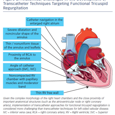 Figure 2 Anatomical Challenges in the Development of Transcatheter Techniques Targeting Functional Tricuspid Regurgitation