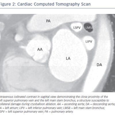 Figure 2 Cardiac Computed Tomography Scan
