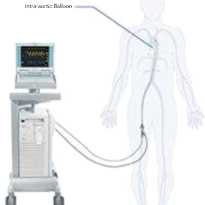 Figure 2 Components of Intra-aortic Balloon Pump