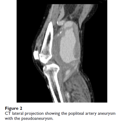 figure 2-ct-lateral-projection