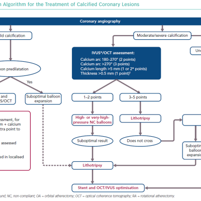 Decision Algorithm for the Treatment of Calcified Coronary Lesions