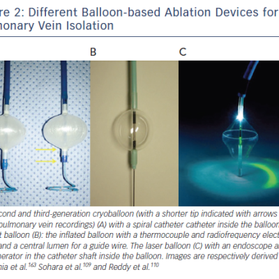 Different Balloon-based Ablation Devices