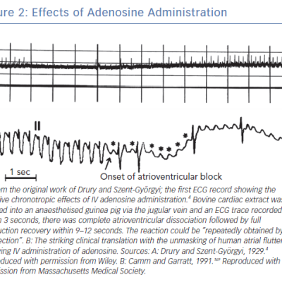 Effects of Adenosine Administration