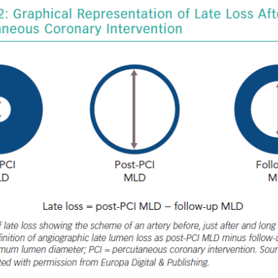 Graphical Representation of Late Loss After Percutaneous Coronary Intervention