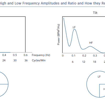 Illustration of the high &ampamp Low Frequency Amplitudes and Ration