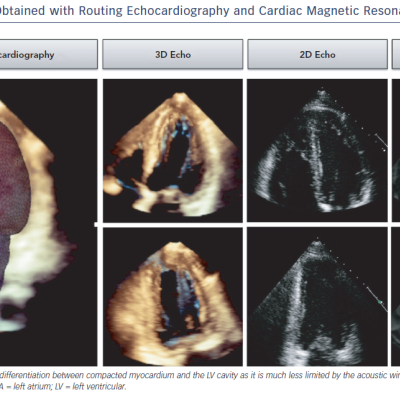 Figure 2 Image Quality Obtained with Routing Echocardiography and Cardiac Magnetic Resonance