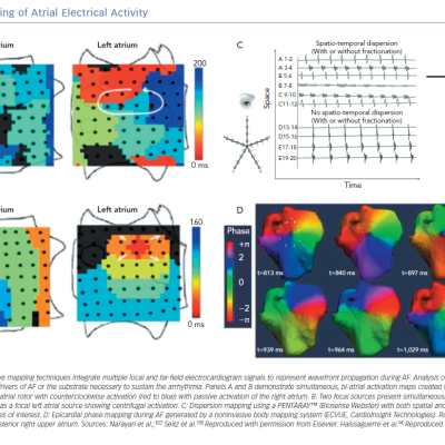 Mapping of Atrial Electrical Activity