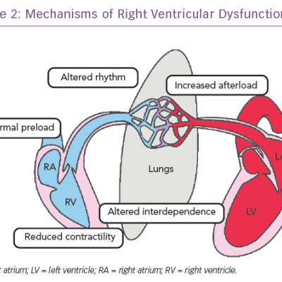 Mechanisms of Right Ventricular Dysfunction