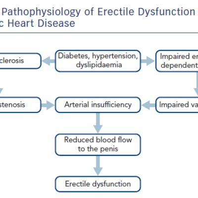 Pathophysiology of Erectile Dysfunction and Ischaemic Heart Disease