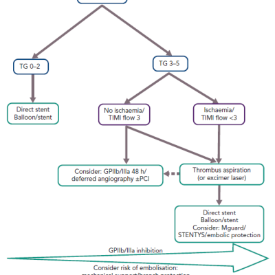 Proposed Algorithm for Primary PCI in the Presence of Large Thrombus Burden