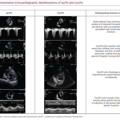 Representative Echocardiographic Manifestations of IpcPH and CpcPH