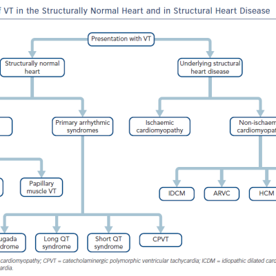 The Aetiology of VT in the Structurally Normal Heart and in Structural Heart Disease
