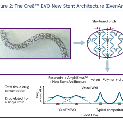 Figure 2 The Cre8™ EVO New Stent Architecture EvenArt