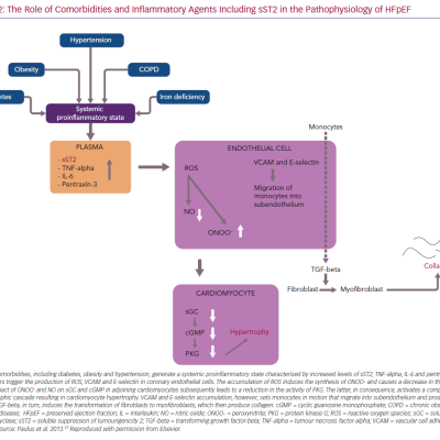 The Role of Comorbidities and Inflammatory