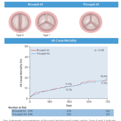 Figure 2 Transcatheter Aortic Valve Implantation for Bicuspid Versus Tricuspid Aortic Valve Stenosis