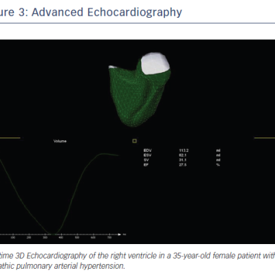 Figure 3 Advanced Echocardiography