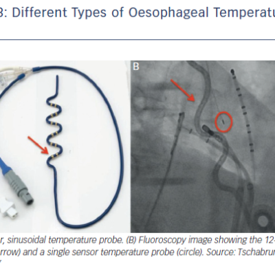 Figure 3 Different Types of Oesophageal Temperature Probes