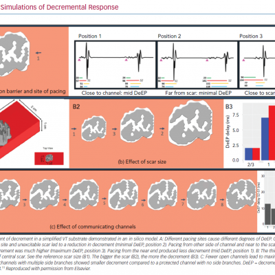 In Silico Simulations of Decremental Response