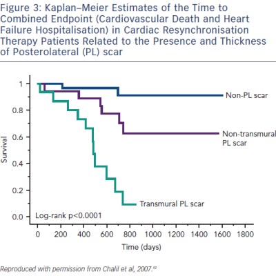 Figure 3 Kaplan–Meier Estimates of the Time to Combined Endpoint Cardiovascular Death and Heart Failure Hospitalisation in Cardiac Resynchronisation Therapy Patients Related to the Presence and Thickness of Posterolateral PL scar