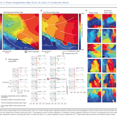 Phase Singularities May Occur at Lines of Conduction Block