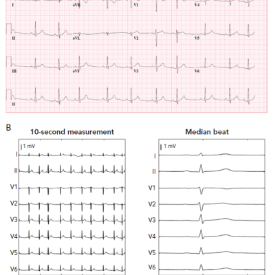 Standardised Clinical Visualised Signals