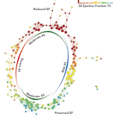 The Patient-similarity Network Ejection Fraction