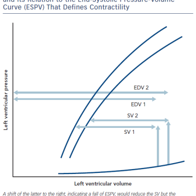 Figure 3 The Principle of Ejection Fraction EF Which Is Stroke Volume SV Divided by End-Diastolic Volume EDV and Its Relation to the End-Systolic Pressure-Volume Curve ESPV That Defines Contractility