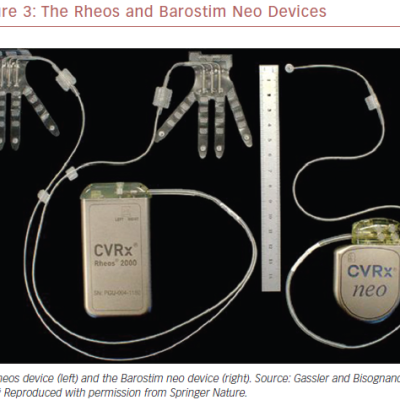 The Rheos and Barostim Neo Devices